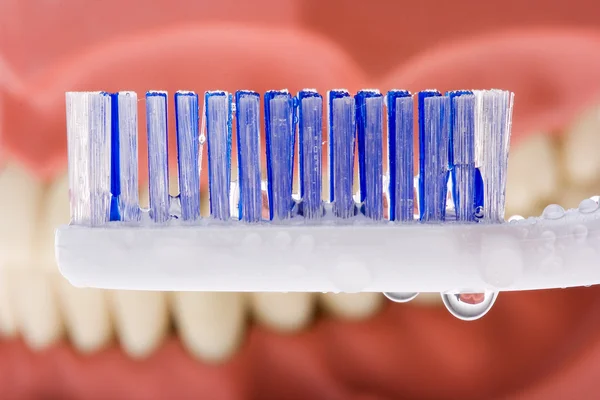 Stampo dentale e spazzolino da denti — Foto Stock