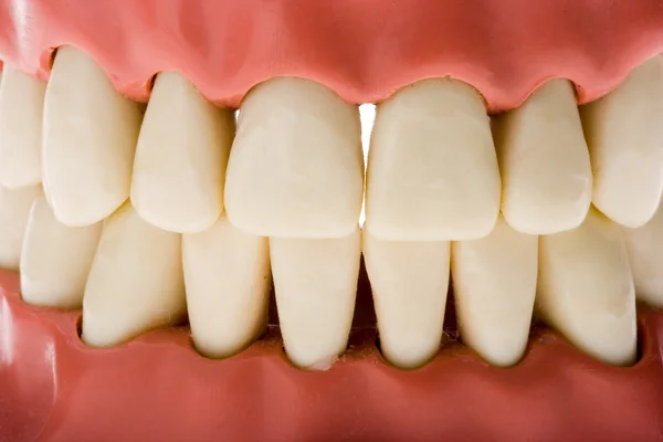 Molde dental 2 — Foto de Stock
