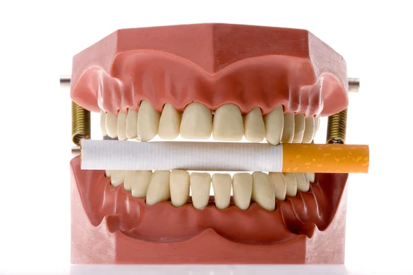 Οδοντιατρική μούχλα δαγκώνει ένα τσιγάρο — Φωτογραφία Αρχείου