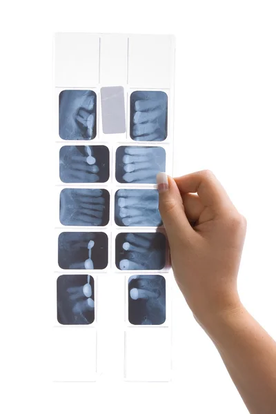 In hand x-rays — Stock Photo, Image