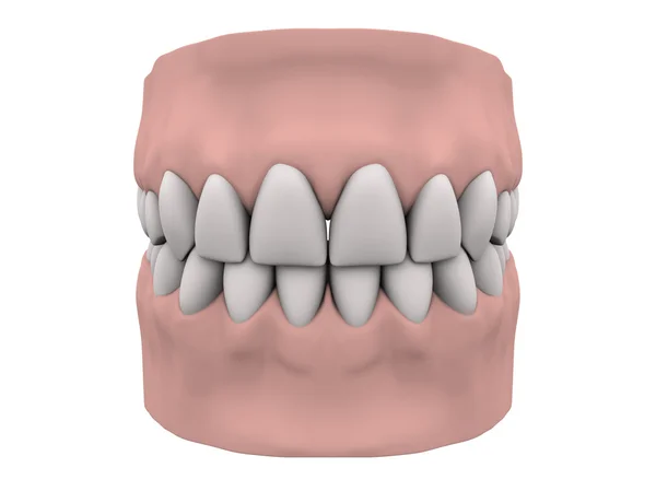 牙齿和牙龈 — 图库照片