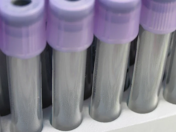 stock image A row of laboratory test tubes with purple caps.