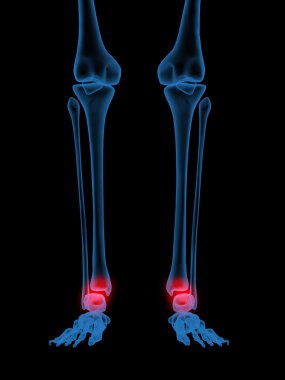 X-Ray of Human ankle clipart