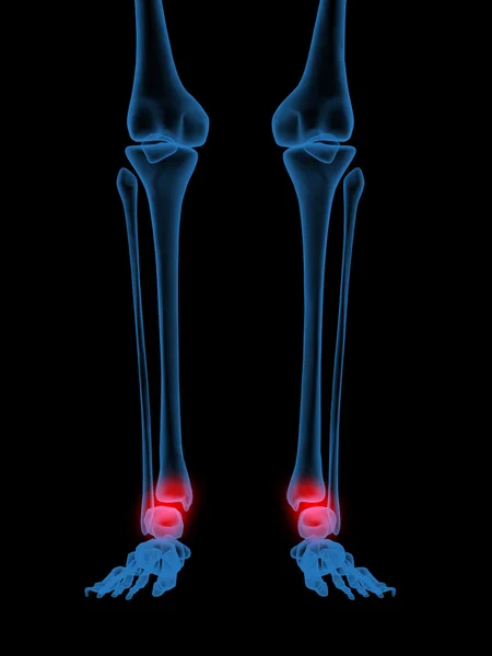 X-Ray of Human ankle — Stock Photo, Image