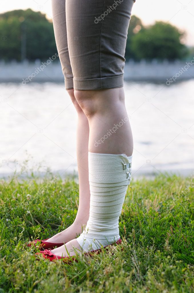 A woman with bandage on injured leg — Stock Photo © mary_smn 6074389