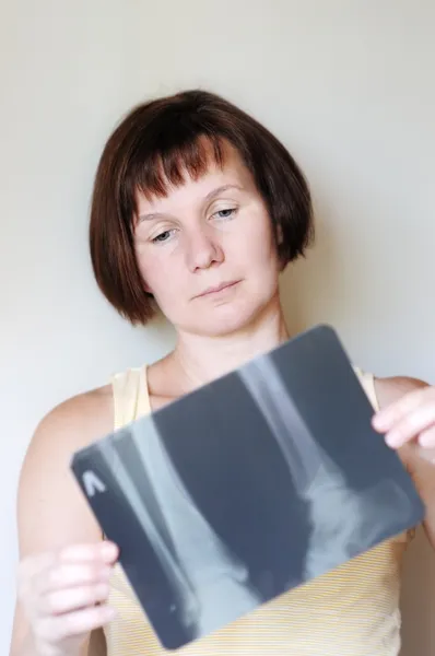Femme tenant une image radiographique — Photo