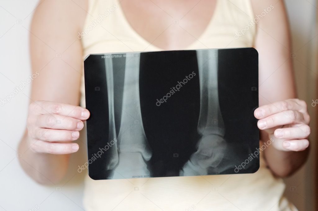 Woman holding an x-ray image