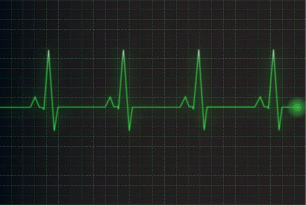 Ilustração da atividade elétrica do coração humano — Vetor de Stock