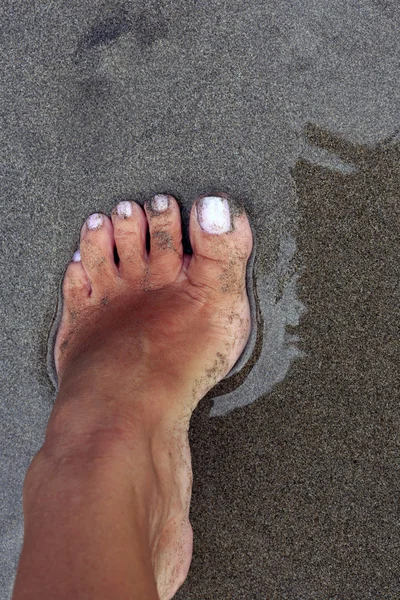Sunburnt жіночих ніг — стокове фото