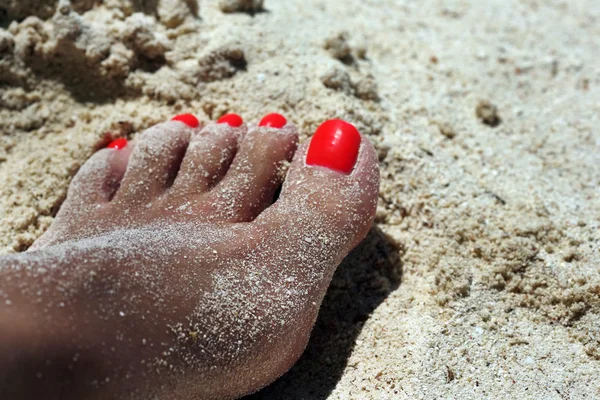 Güneş yanığı kadın bacak — Stok fotoğraf