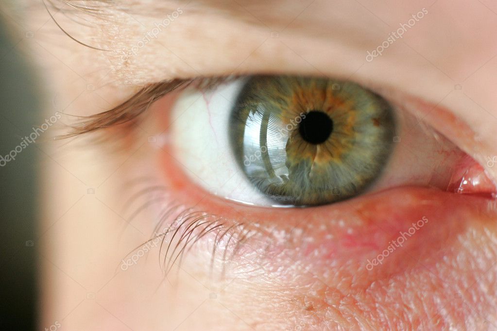 http://static6.depositphotos.com/1125999/617/i/950/depositphotos_6171184-stock-photo-green-eye.jpg