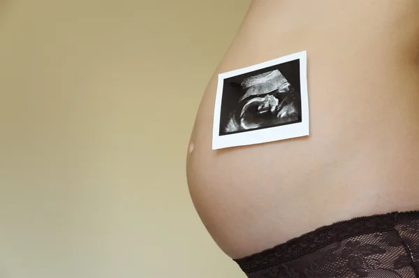 Pregnant woman with a ultrasonic picture — Stock Photo, Image