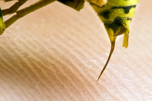 Wasp stinging a human — Stock Photo, Image