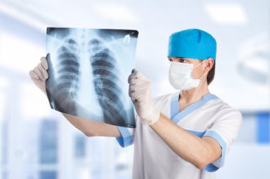 Tıp doktoru hastanedeki akciğerlerin röntgenine bakıyor.