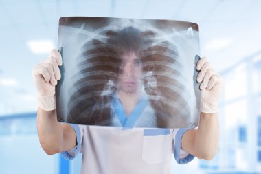 Tıp doktoru hospita akciğerlerde x-ray fotoğrafını aramak