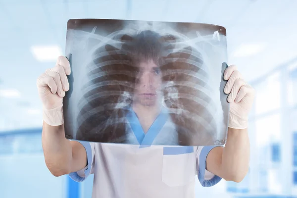 Médico olhando através de raio-x imagem dos pulmões em hospita — Fotografia de Stock