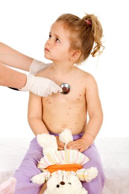 Little girl with small pox at the doctors clipart