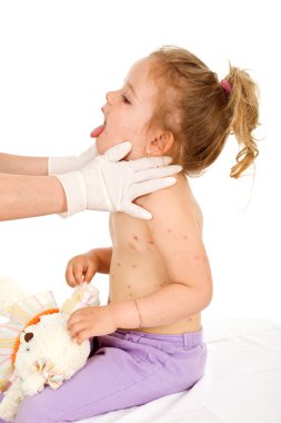 Little girl with small pox at the doctors clipart