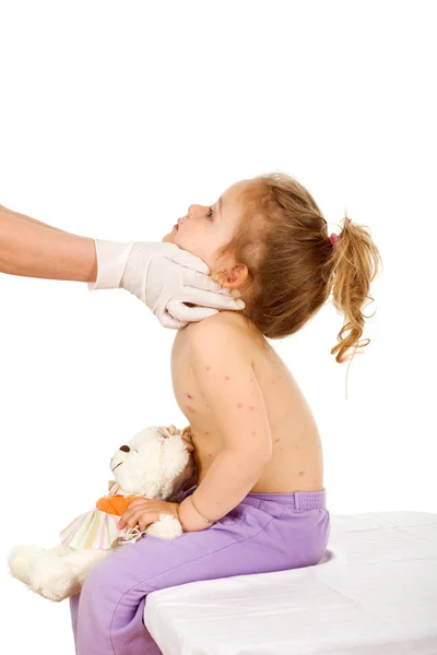 Врач осматривает ребенка с оспой или кожной сыпью — стоковое фото