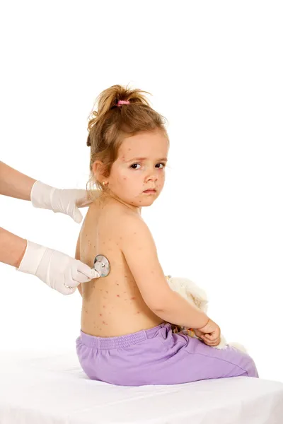 Bambina con piccola varicella dai medici — Foto Stock