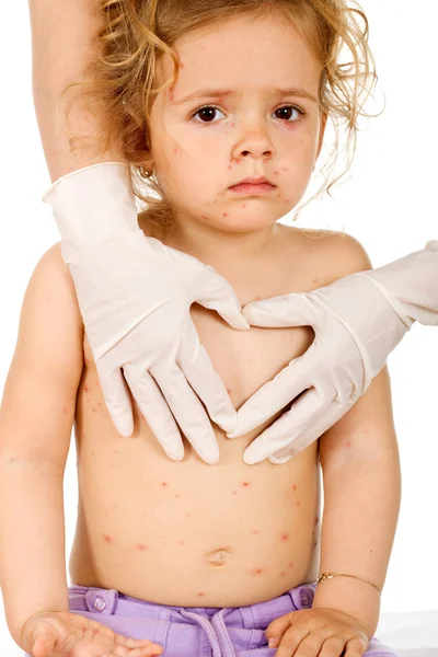 Грустная маленькая девочка с оспой у врачей — стоковое фото