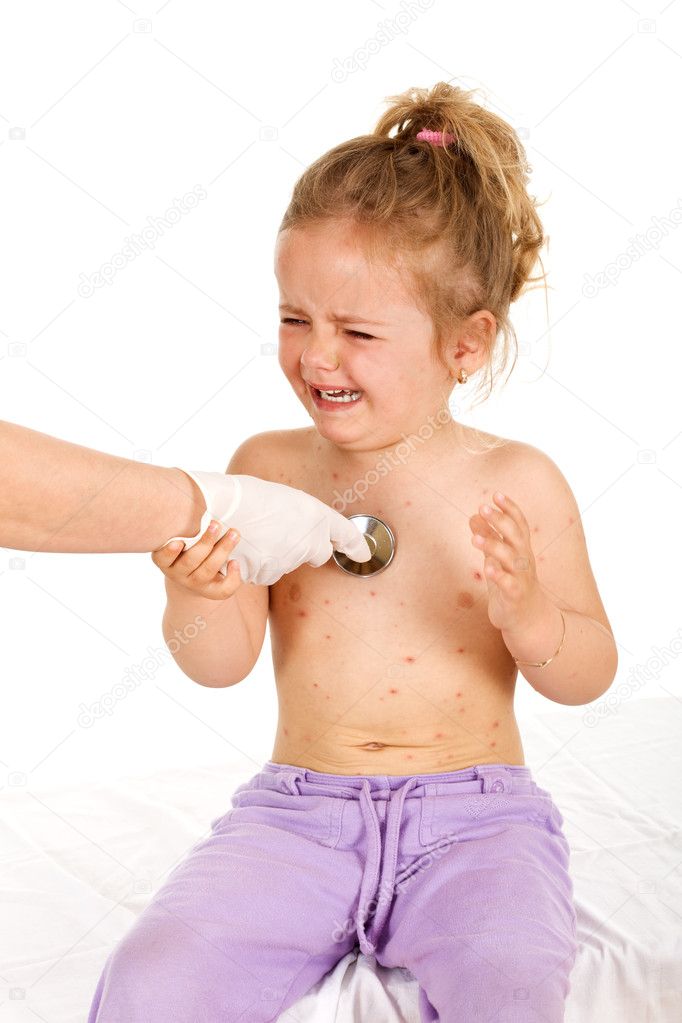 Crying little girl with small pox