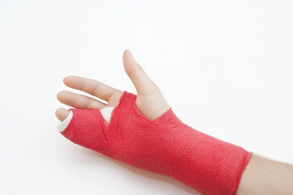 Bandagierter Arm mit gebrochenem Finger Stockfoto