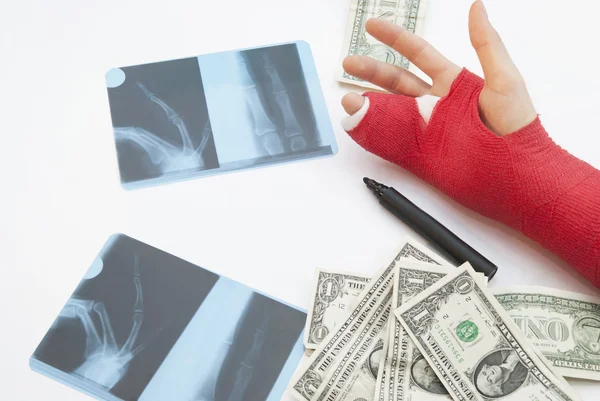 Bandaged Arm, X-Rays, Money And Pen — Stock Photo, Image