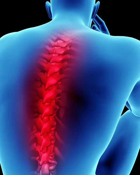 Rückenschmerzen beim Menschen im Rückenmark — Stockfoto
