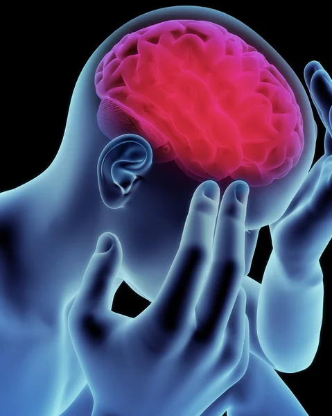 Agy feje fáj, migrén, Alzheimer-kór vagy a demencia koncepció — Stock Fotó