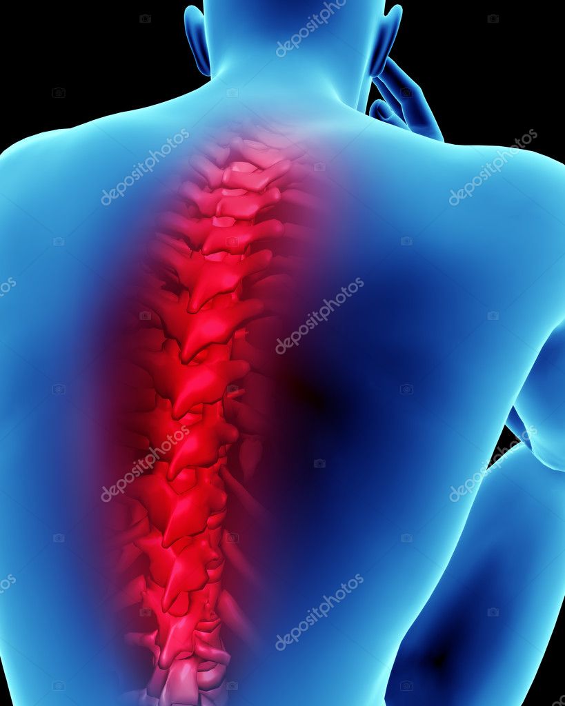 Human back pain spinal cord concept Stock Photo by ©digitalstorm 6590195