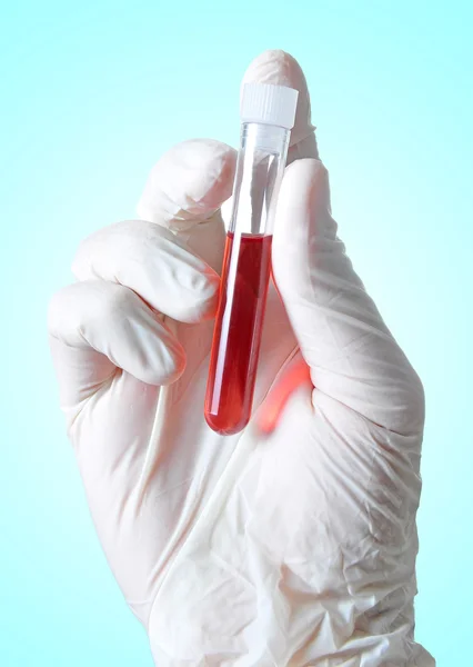 Аналіз крові — стокове фото