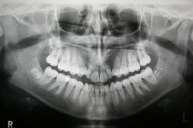 Dental X-ray clipart